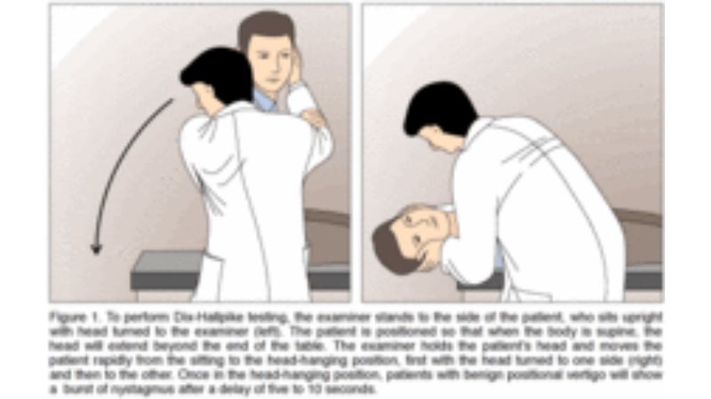 Dix-Hallpike test