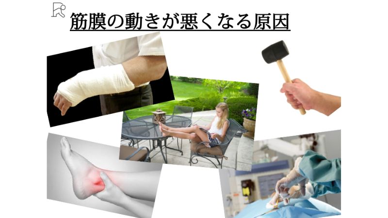 筋膜の動きが悪くなる原因